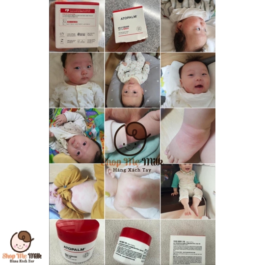 Kem dưỡng Atopalm Mlee Cream Hàn 160mg cho bé sơ sinh ( đặc trị dưỡng da viêm cơ địa)