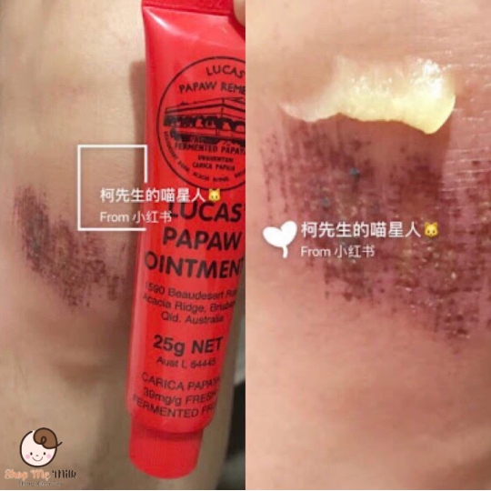 Kem Lucas Pawpaw đa năng của Úc 25g ( Bôi da bé, bôi môi khô nứt, viêm chàm da)