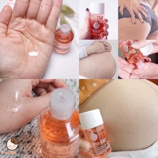 Dầu dưỡng giúp mờ sẹo & giảm rạn da Bio-Oil (125ml) Úc