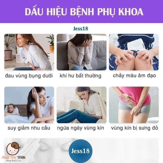 Viên uống Optibac Probiotics - Hỗ trợ phụ khoa cho nữ giới mẫu mới