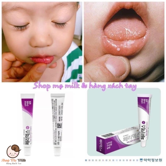 Kem trị nhiệt miệng Peridex Hàn Quốc ( bé từ 1 tuổi & người lớn)