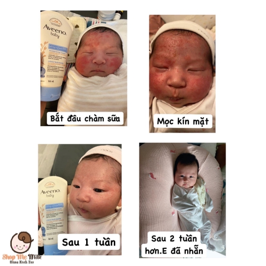 Kem dưỡng chàm viêm da Aveenobaby Eczematherapy 206g Úc Hàng Air