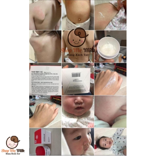 Kem dưỡng Atopalm Mlee Cream Hàn 160mg cho bé sơ sinh ( đặc trị dưỡng da viêm cơ địa)
