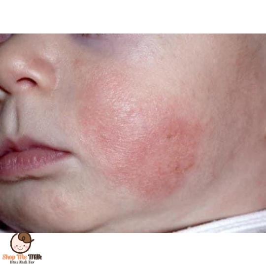 Kem Dexeryl 50g đặc trị các loại nẻ chàm, khô da, viêm da cơ địa Của Pháp